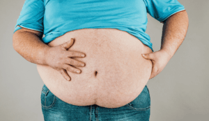 drmyu.com-treatments-Obesity due to gas